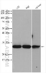 GSTK1 Antibody in Western Blot (WB)