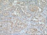 DHRS9 Antibody in Immunohistochemistry (Paraffin) (IHC (P))