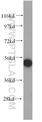DHRS9 Antibody in Western Blot (WB)