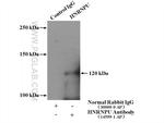 HNRNPU Antibody in Immunoprecipitation (IP)