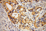 B3GALTL Antibody in Immunohistochemistry (Paraffin) (IHC (P))