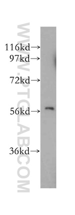 B3GALTL Antibody in Western Blot (WB)