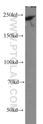 MYO18A Antibody in Western Blot (WB)