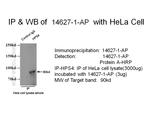 HPS4 Antibody in Immunoprecipitation (IP)