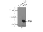 RMI1 Antibody in Immunoprecipitation (IP)