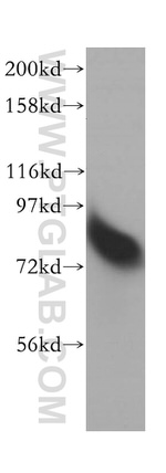 RMI1 Antibody in Western Blot (WB)