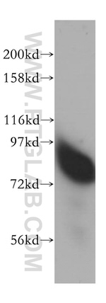 RMI1 Antibody in Western Blot (WB)