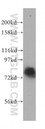 RMI1 Antibody in Western Blot (WB)