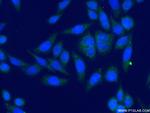 DDX6 Antibody in Immunocytochemistry (ICC/IF)