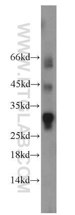 RPL13A Antibody in Western Blot (WB)