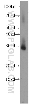 RPL13A Antibody in Western Blot (WB)