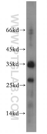 RPL13A Antibody in Western Blot (WB)