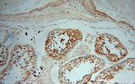 PPP1R15B Antibody in Immunohistochemistry (Paraffin) (IHC (P))