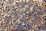 PPP1R15B Antibody in Immunohistochemistry (Paraffin) (IHC (P))