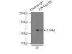 PPP1R15B Antibody in Immunoprecipitation (IP)