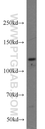 PPP1R15B Antibody in Western Blot (WB)