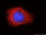 IGF2BP3 Antibody in Immunocytochemistry (ICC/IF)