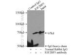 IGF2BP3 Antibody in Immunoprecipitation (IP)