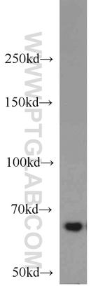 IGF2BP3 Antibody in Western Blot (WB)