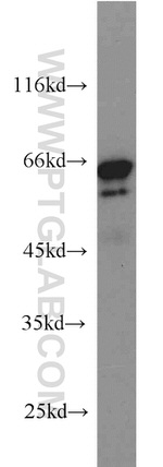 IGF2BP3 Antibody in Western Blot (WB)