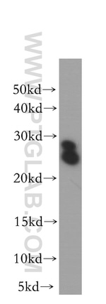 LIN7C Antibody in Western Blot (WB)