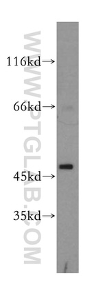 Decorin Polyclonal Antibody (14667-1-AP)