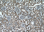 ATP5A1 Antibody in Immunohistochemistry (Paraffin) (IHC (P))