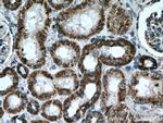 ATP5A1 Antibody in Immunohistochemistry (Paraffin) (IHC (P))