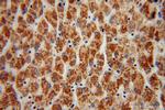 ATP5A1 Antibody in Immunohistochemistry (Paraffin) (IHC (P))