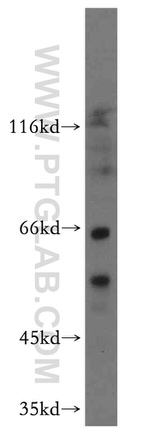 ATP5A1 Antibody in Western Blot (WB)