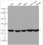 ATP5A1 Antibody in Western Blot (WB)