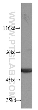 ATP5A1 Antibody in Western Blot (WB)