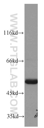 ATP5A1 Antibody in Western Blot (WB)