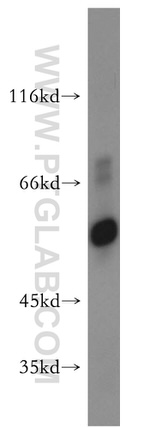 ATP5A1 Antibody in Western Blot (WB)