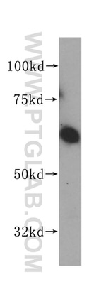 ASNS Antibody in Western Blot (WB)