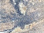 ASNS Antibody in Immunohistochemistry (Paraffin) (IHC (P))