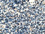 ASNS Antibody in Immunohistochemistry (Paraffin) (IHC (P))