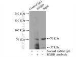RXRB Antibody in Immunoprecipitation (IP)