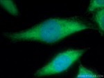 KCNAB1 Antibody in Immunocytochemistry (ICC/IF)