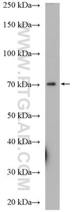 KCNAB1 Antibody in Western Blot (WB)