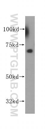 PAPSS1 Antibody in Western Blot (WB)