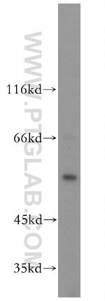 MPP1 Antibody in Western Blot (WB)