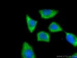 AHSA1 Antibody in Immunocytochemistry (ICC/IF)