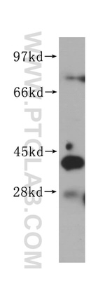 AHSA1 Antibody in Western Blot (WB)