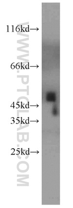 UQCRC2 Antibody in Western Blot (WB)