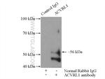 ACVRL1 Antibody in Immunoprecipitation (IP)