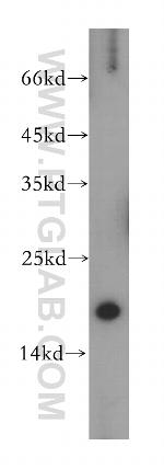 SEC11A Antibody in Western Blot (WB)