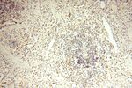 WRAP53 Antibody in Immunohistochemistry (Paraffin) (IHC (P))