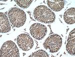 WRAP53 Antibody in Immunohistochemistry (Paraffin) (IHC (P))