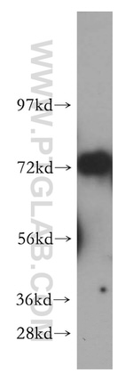 WRAP53 Antibody in Western Blot (WB)